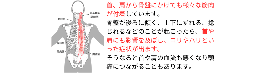 身体のゆがみが引き起こすこと